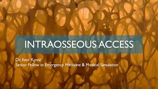 Intraosseous access [upl. by Abie485]