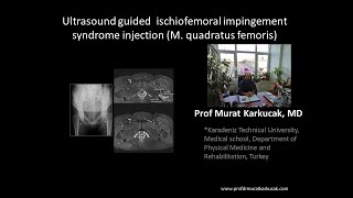 Ultrasound guided ischiofemoral impingement syndrome injection M quadratus femoris [upl. by Merth]