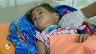 Diphtheria takes a deadly stranglehold on wartorn Yemen [upl. by Freida]