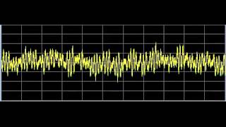 Alopecia Hair Loss  Rife Frequencies [upl. by Iris983]