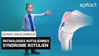 Syndrome Rotulien  Explication  EPITACT [upl. by Adeirf515]