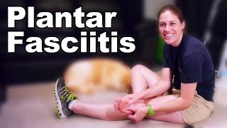 Top 10 Ways To Cure Plantar Fasciitis [upl. by Aneeroc]