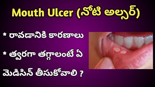 Mouth Ulcers Reasons and Treatment in Telugu [upl. by Nirej]