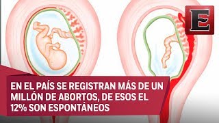 Punto y coma Aborto espontáneo [upl. by Westfahl265]