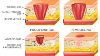 WOUND HEALING [upl. by Coveney]