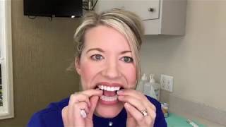 Teeth Whitening Instructions [upl. by Neff]