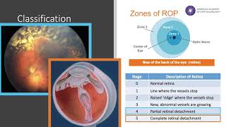 Eye Injections at Royal Bournemouth Hospital [upl. by Elwira]