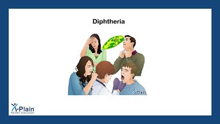 Diphtheria [upl. by Anilec336]