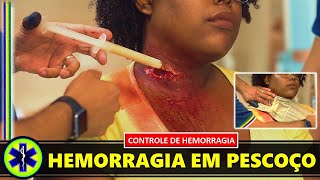 Controle de Hemorragias em Pescoço [upl. by Mcgean]