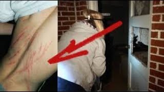 SCRATCHED BY DEMON AT 3AM  OmarGoshTV [upl. by Armalla]