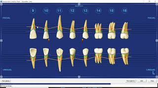 Dentrix Perio Chart Features by Practice Strategies [upl. by Yasmeen]