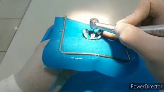 Endodontia em Dentes Decíduos [upl. by Keelin]