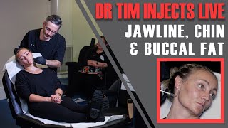 FULL JAWLINE TREATMENT Dr Tim Injects Jawline Chin amp Buccal Fat Live Aesthetics Mastery Show [upl. by Nylahsoj391]