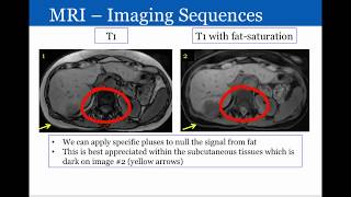 Introduction to Radiology Magnetic Resonance Imaging [upl. by Ylime]