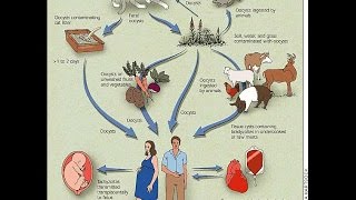 Congenital Toxoplasmosis [upl. by Aneleve]