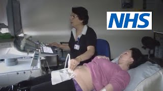 What happens at a scan and what will they tell me  NHS [upl. by Groveman]