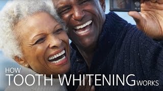 How Tooth Whitening Works [upl. by Luba464]