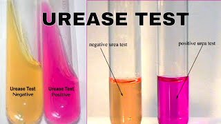 Urea Hydrolysis Urease Test [upl. by Yoc820]