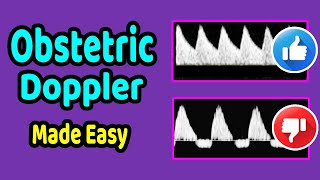 Obstetric Doppler Made Easy [upl. by Leuas]