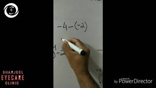 Retinoscopy 3  calculation [upl. by Vernor]