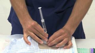 01 Cannula Insertion [upl. by Ruzich]