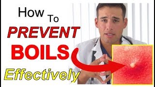 How to PREVENT Boils Effectively 4 STEPS  The Best Way to PREVENT Boils From Coming Back [upl. by Towny273]