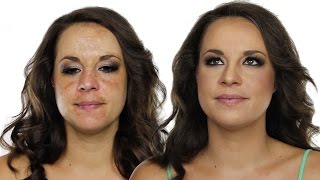 How To Cover Hyperpigmentation  Skin Pigmentation Using MakeUp  Shonagh Scott  ShowMe MakeUp [upl. by Nakeber263]