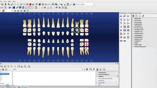 Hard Tissue Charting on Dentrix [upl. by Vladamir]