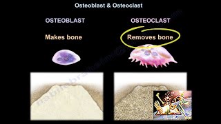 Osteomalacia amp Rickets  Cause Symptom Treatment Diagnosis MedicalSurgical amp Nursing Management [upl. by Lupe]