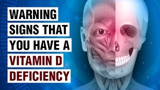 14 Signs Of Vitamin D Deficiency [upl. by Nahtannhoj343]