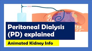 Intraperitoneal injection in rat [upl. by Inalak]