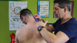 Trigger Point Therapy  Taping for Levator Scapulae [upl. by Anaig388]