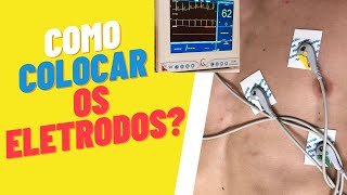 Como Colocar os Eletrodos de ECG eletrocardiograma enfermagem nasctreinamentosenfermagem [upl. by Erek]