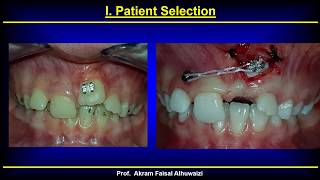 TADs 2018 Part 2 Surgical procedure English [upl. by Jaylene]