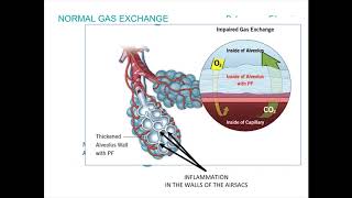 AntiInflammatory amp Immunosuppressive Medications Webinar [upl. by Adohr965]