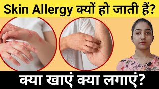 Skin Allergy क्यों हो जाती हैक्या खाएं क्या लगाएंAlka Thakur [upl. by Hearsh26]