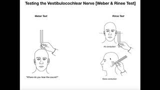 Interpreting the WeberRinne Tests EXPLAINED [upl. by Betthezel358]