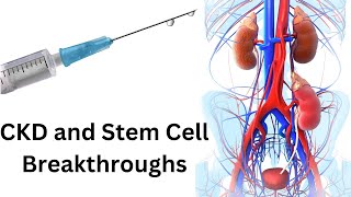 CKD and Stem Cell Breakthroughs Changing the Landscape of Kidney Care [upl. by Lothar726]