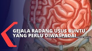 Pahami Gejala Penyebab Hingga Cara Mencegah Radang Usus Buntu [upl. by Nnaeoj82]