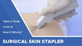 Surgical Skin Stapler Take a Close Look at How it Works [upl. by Francene963]