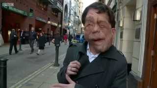 The Ugly Face of Disability Hate Crime  BBC Documentary [upl. by Warring]