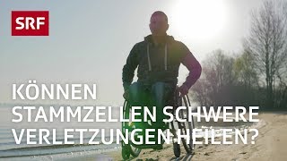 Stammzellen Ein Wundermittel der Medizin  Erklärvideo  SRF [upl. by Whitney]