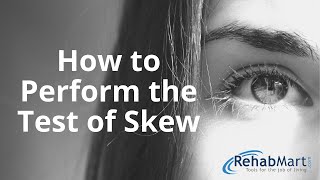 How to Perform the Test of Skew for Vertigo [upl. by Chassin]