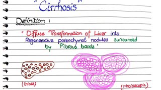 Cirrhosis of Liver  Pathology [upl. by Templas]