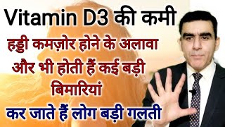 विटामिन डी की कमी से क्या होता है  Vitamin D3 Ki Kami se Kya Hota h  Vitamin D Deficiency [upl. by Anim]