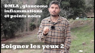 DMLA  glaucome inflammations et points noirs  Soigner les yeux épisode 2  regenereorg [upl. by Orlena]