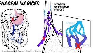 Pulmonary hypertension treatment  Respiratory system diseases  NCLEXRN  Khan Academy [upl. by Murry]