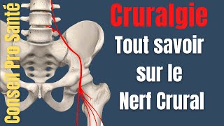 Cruralgie  Quest ce que le nerf crural  nerf fémoral [upl. by Gradeigh850]