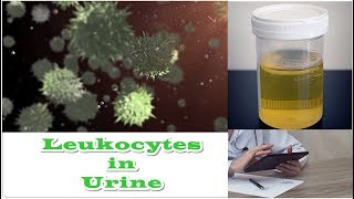 Leukocytes in Urine  No Nitrates [upl. by Koziel541]