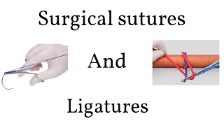 BRACES EXPLAINED Color and Steel Ligature Ties [upl. by Aral686]